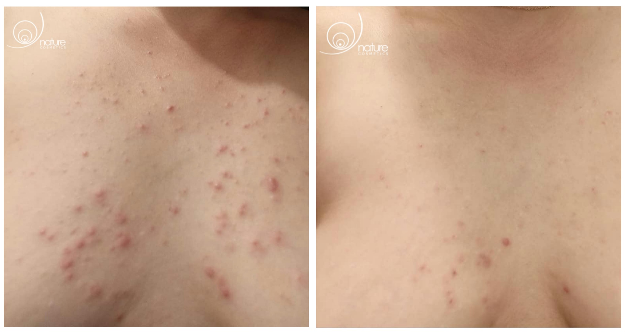 manuelle Hautreinigung mit Healthy Skin